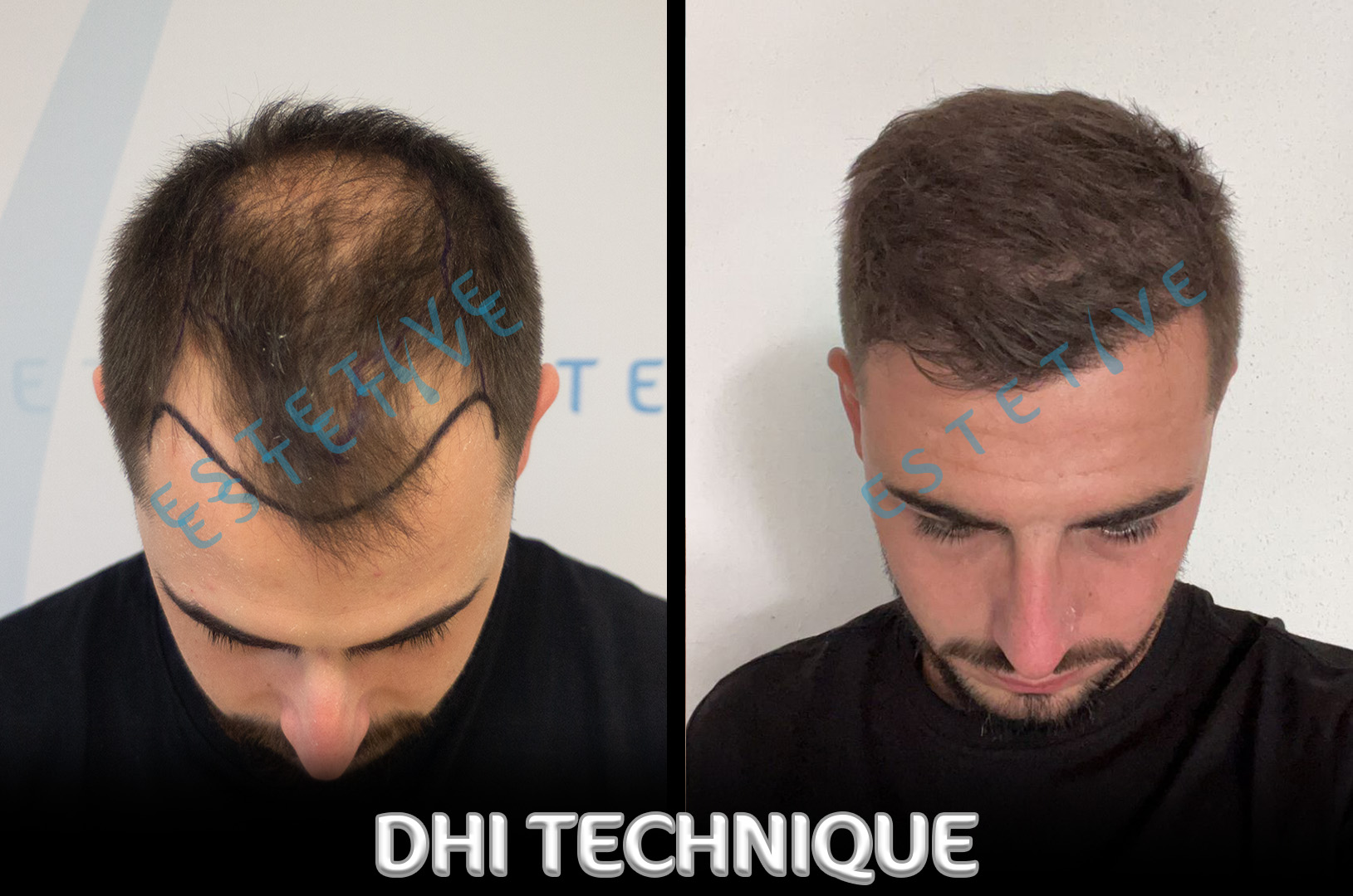 BEFOREAFTERREV