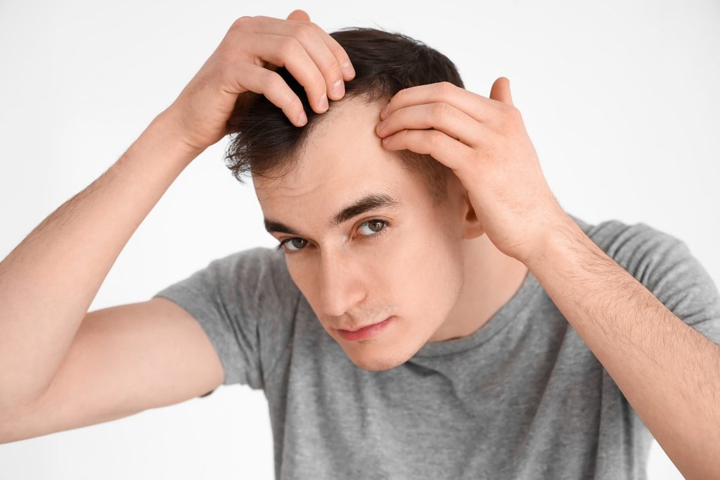 Greffe de cheveux